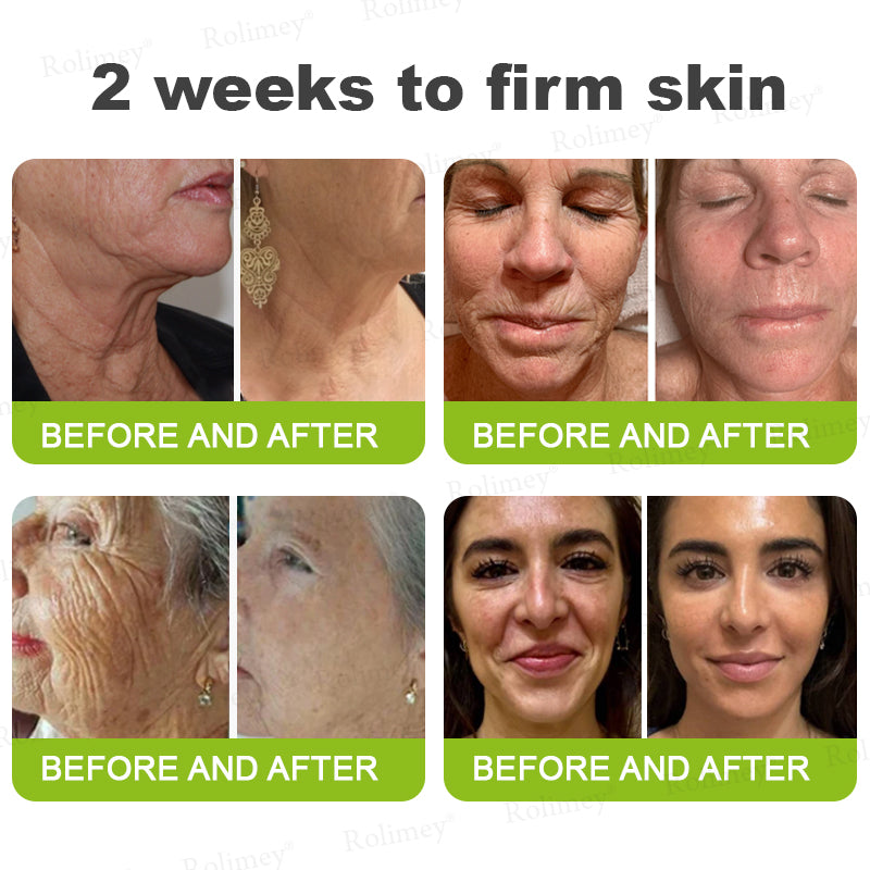 🇺🇸 Made and shipped from the USA 🗽🔖Rolimey® Botox & Vita-A Retinol Shot Wrinkle-Lift Tightening cream - Last Day Promotion 50% OFF