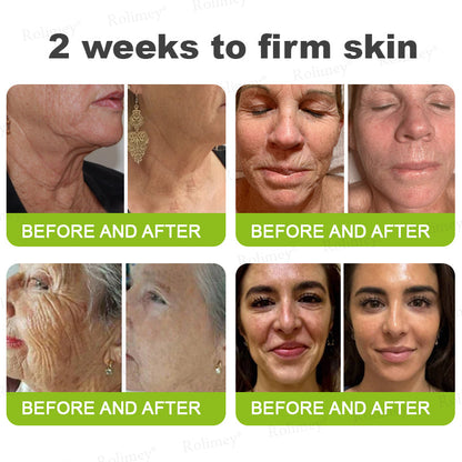 🇺🇸 Made and shipped from the USA 🗽🔖Rolimey® Botox & Vita-A Retinol Shot Wrinkle-Lift Tightening cream - Last Day Promotion 50% OFF