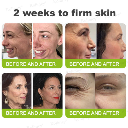 🇺🇸 Made and shipped from the USA 🗽🔖Rolimey® Botox & Vita-A Retinol Shot Wrinkle-Lift Tightening cream - Last Day Promotion 50% OFF
