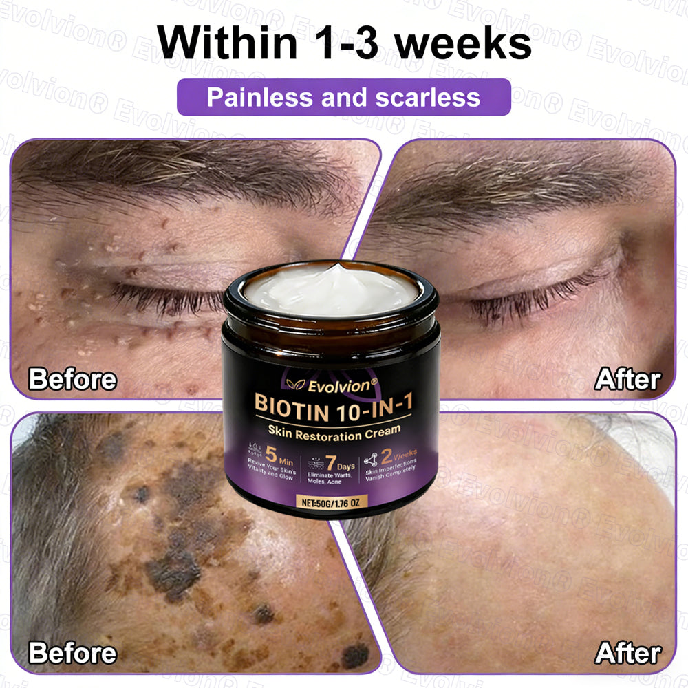Made and Shipped from USA 🗽🔖Evolvion® Biotin 10-in-1 Skin Restoration Cream🍀- Last Day Promotion: 50% OFF