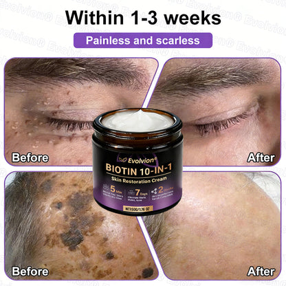 Made and Shipped from USA 🗽🔖Evolvion® Biotin 10-in-1 Skin Restoration Cream🍀- Last Day Promotion: 50% OFF