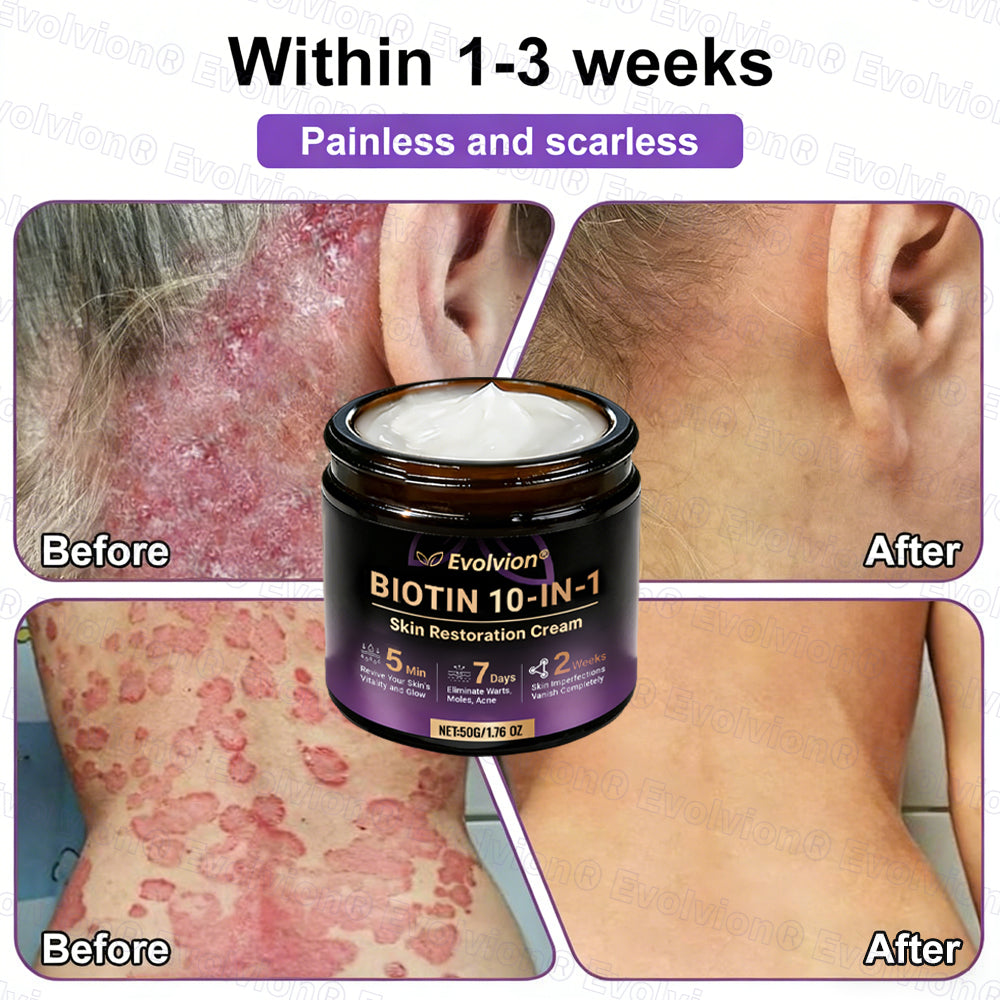 Made and Shipped from USA 🗽🔖Evolvion® Biotin 10-in-1 Skin Restoration Cream🍀- Last Day Promotion: 50% OFF