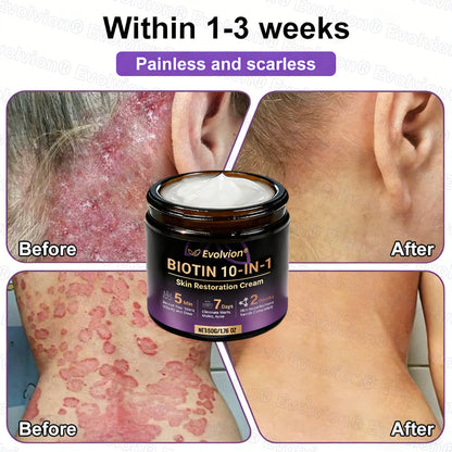 Made and Shipped from USA 🗽🔖Evolvion® Biotin 10-in-1 Skin Restoration Cream🍀- Last Day Promotion: 50% OFF