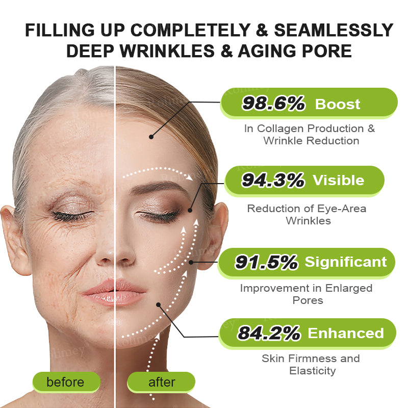 🇺🇸 Made and shipped from the USA 🗽🔖Rolimey® Botox & Vita-A Retinol Shot Wrinkle-Lift Tightening cream - Last Day Promotion 50% OFF