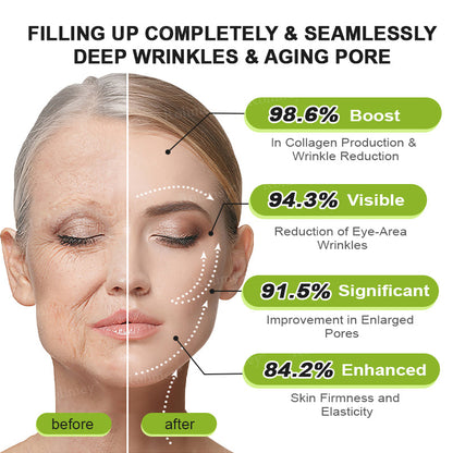 🇺🇸 Made and shipped from the USA 🗽🔖Rolimey® Botox & Vita-A Retinol Shot Wrinkle-Lift Tightening cream - Last Day Promotion 50% OFF