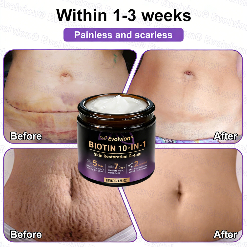 Made and Shipped from USA 🗽🔖Evolvion® Biotin 10-in-1 Skin Restoration Cream🍀- Last Day Promotion: 50% OFF