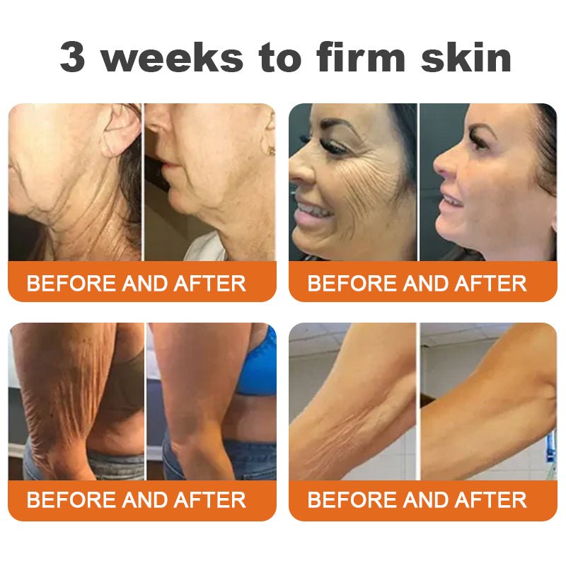 🗽Made and Shipped from USA✨Flysmus™ Botox Bee Venom Firming Serum Stick🔥LAST DAY 70% OFF