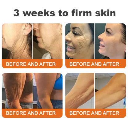 🗽Made and Shipped from USA✨Flysmus™ Botox Bee Venom Firming Serum Stick🔥LAST DAY 70% OFF