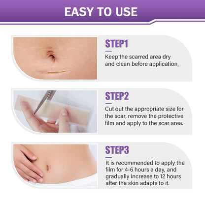 ✅GFOUK® Hyaluronic Acid Nano Microneedle Repair Tape🗽❤️❤️❤️❤️❤️