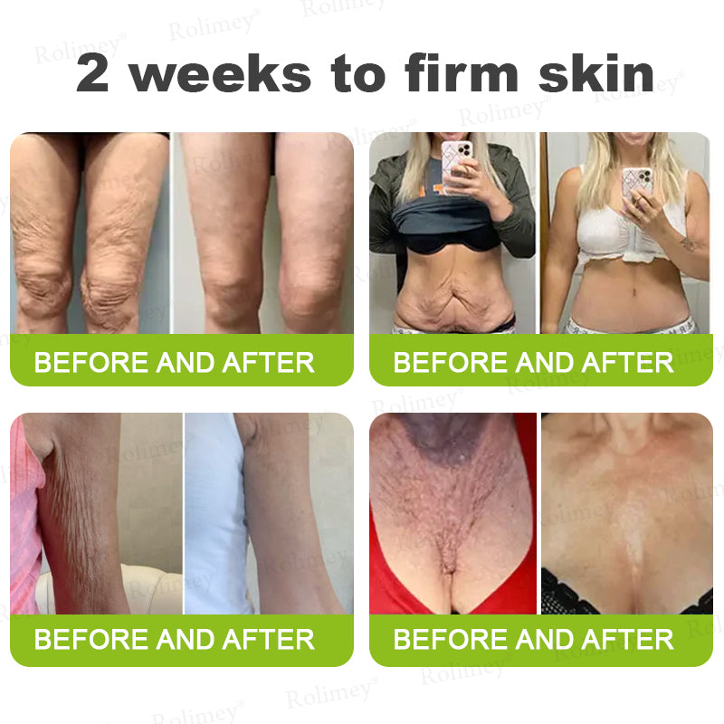 🇺🇸 Made and shipped from the USA 🗽🔖Rolimey® Botox & Vita-A Retinol Shot Wrinkle-Lift Tightening cream - Last Day Promotion 50% OFF