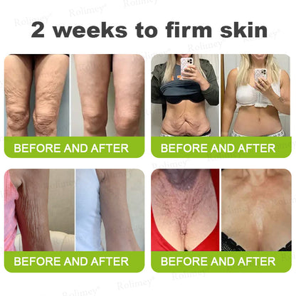 🇺🇸 Made and shipped from the USA 🗽🔖Rolimey® Botox & Vita-A Retinol Shot Wrinkle-Lift Tightening cream - Last Day Promotion 50% OFF