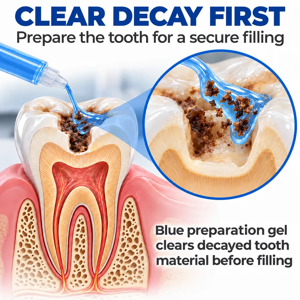 🗽🎁Dr.Fachmer® DentRestore Tooth Repair & Filling System