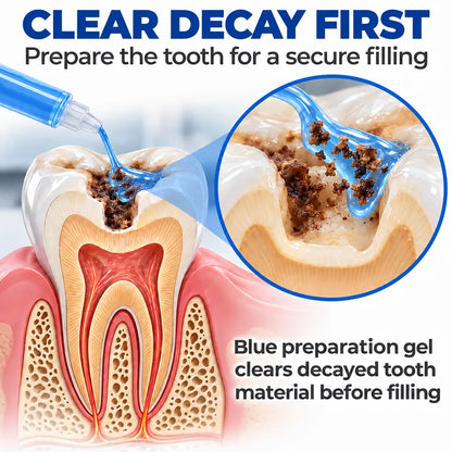 🗽🎁Dr.Fachmer® DentRestore Tooth Repair & Filling System