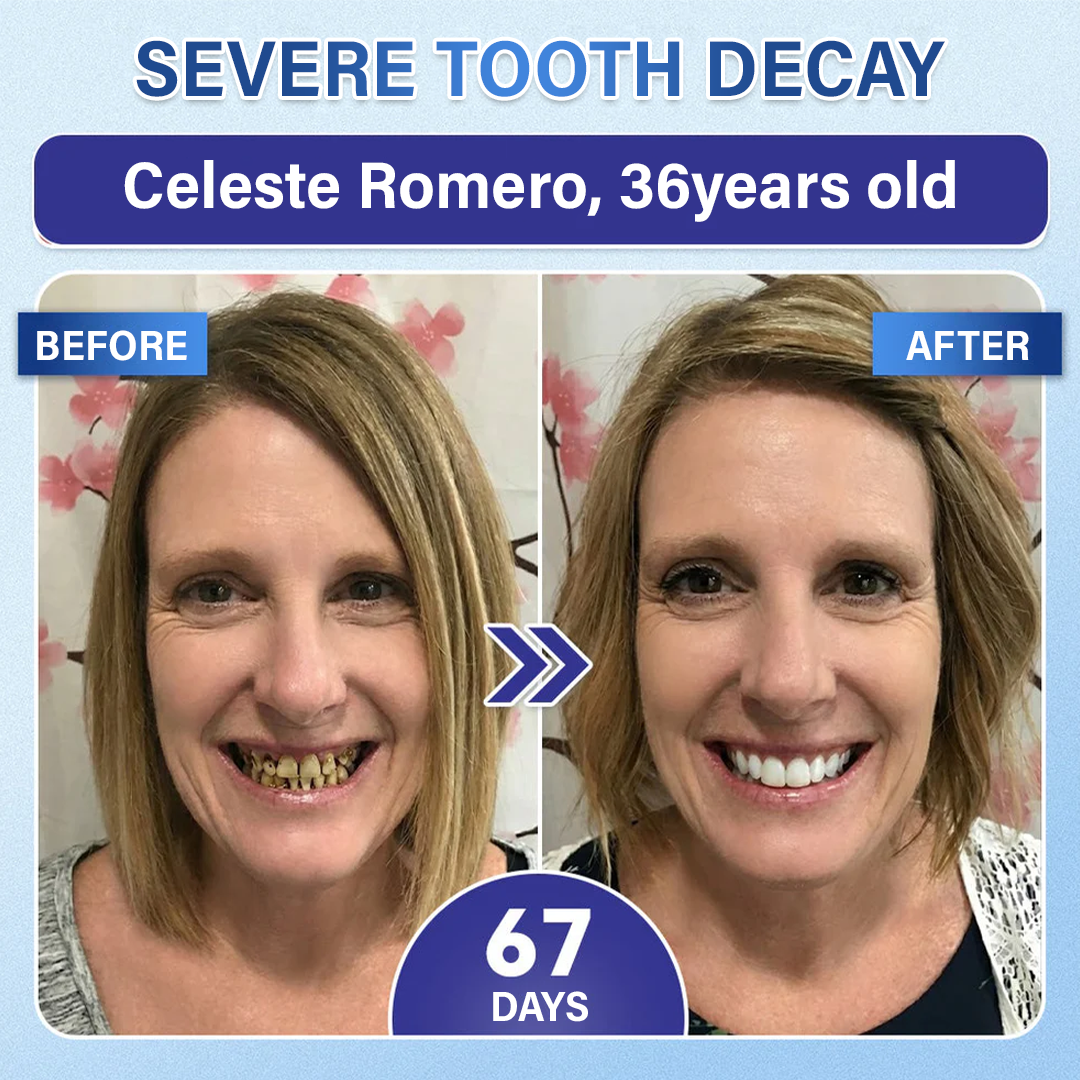 Ceoerty® Tooth & Gum Care Fast-Dissolving Microneedle Patch