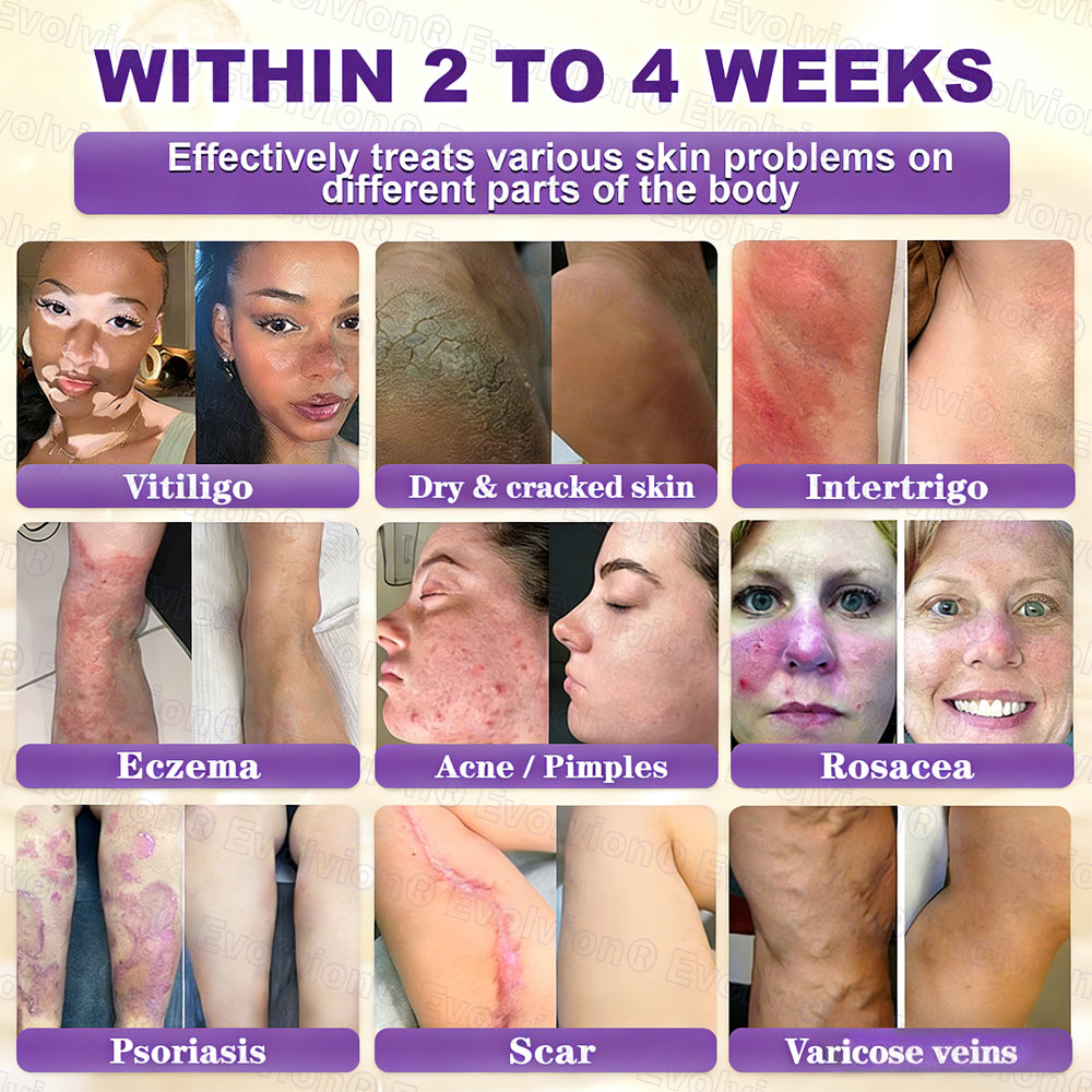 Made and Shipped from USA 🗽🔖Evolvion® Biotin 10-in-1 Skin Restoration Cream🍀- Last Day Promotion: 50% OFF