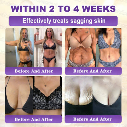 Made and Shipped from USA 🗽🔖Evolvion® Biotin 10-in-1 Skin Restoration Cream🍀- Last Day Promotion: 50% OFF