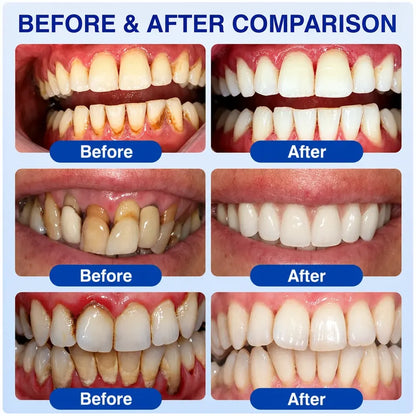 Pheromex®🗽👨‍⚕️GumRevive Periodontal Care Gel