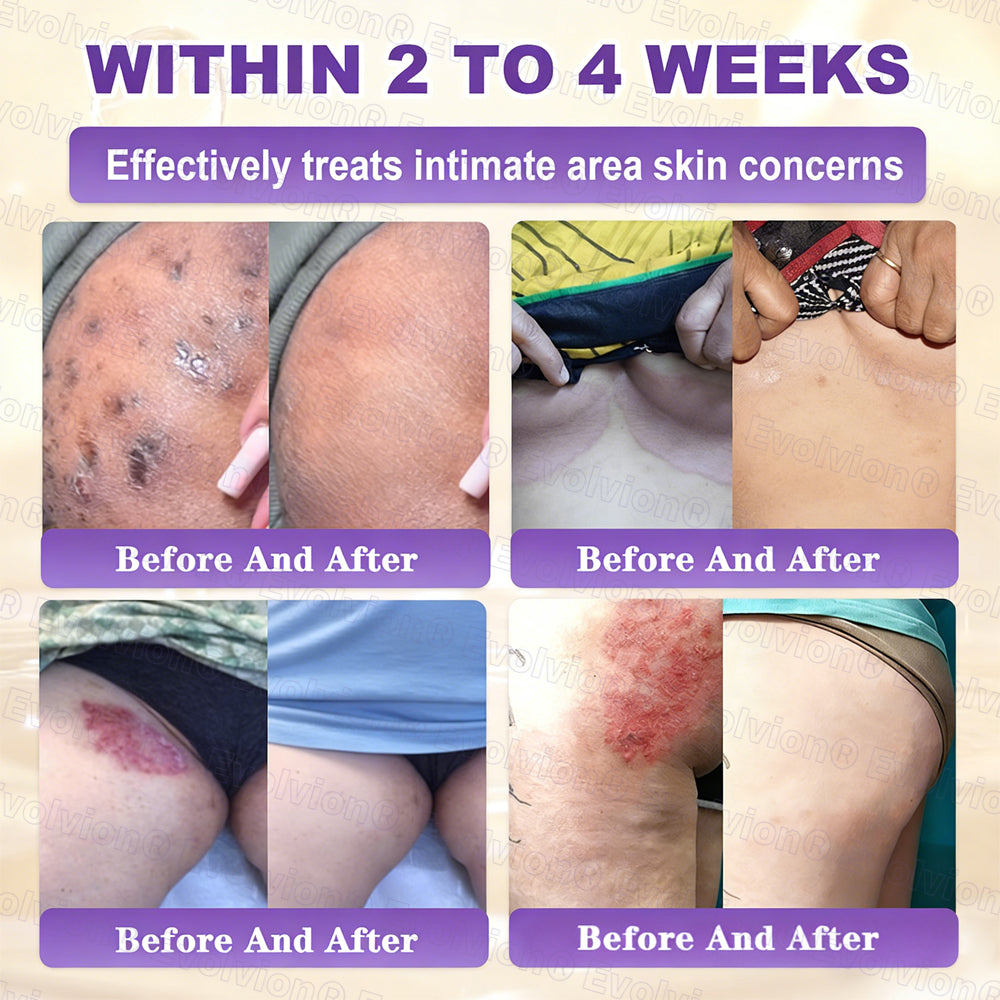 Made and Shipped from USA 🗽🔖Evolvion® Biotin 10-in-1 Skin Restoration Cream🍀- Last Day Promotion: 50% OFF