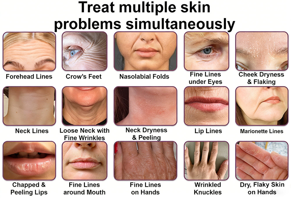 #1 Bestselling🏆--Rolimey® Calcium Multi Balm🗽🔖Anti-Aging & Firming Skincare Stick🔥- Last Day Promotion 50% OFF