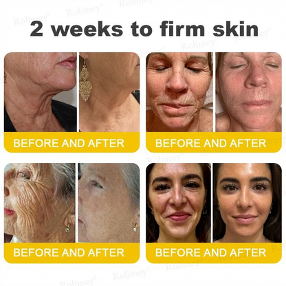 Rolimey®🗽Botox & Vita A Retinol Shot Tightening Cream🗽