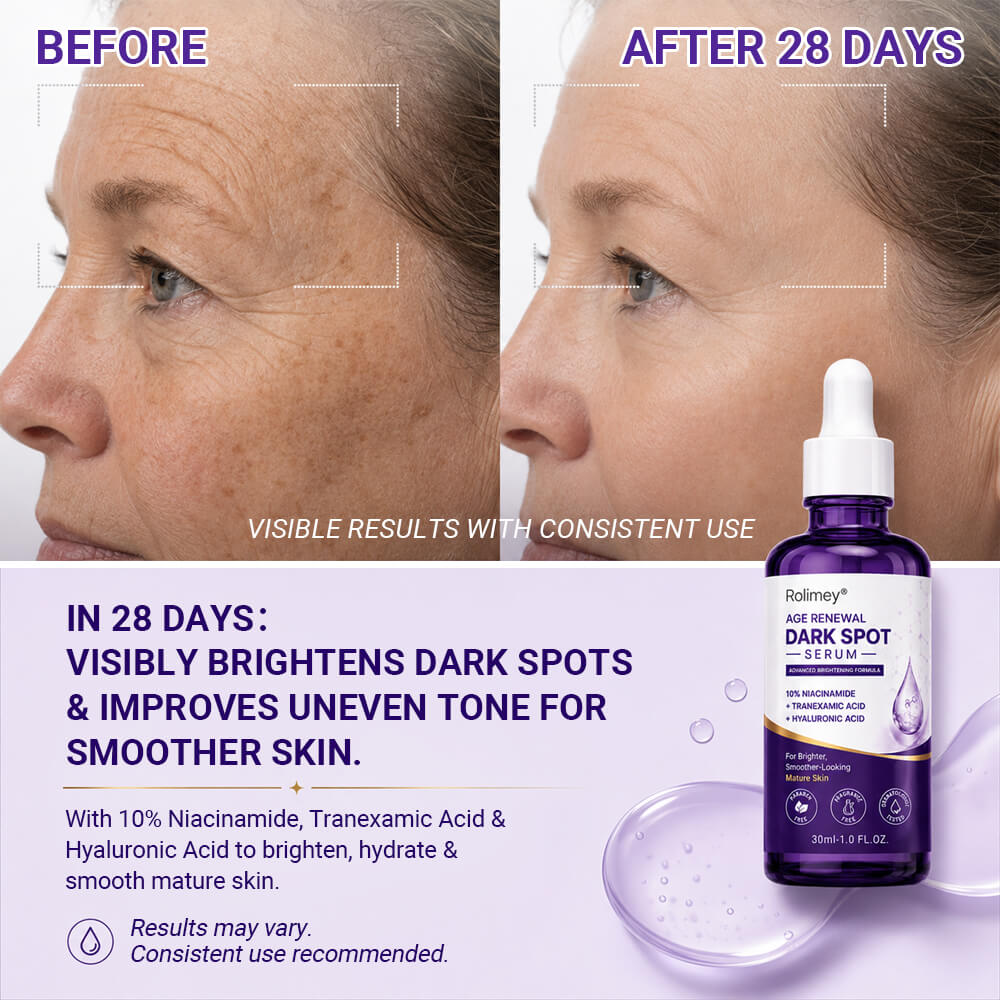 🗽❤️❤️❤️❤️Rolimey® Age Renewal Dark Spot Serum — Infused with 10% Niacinamide, Tranexamic Acid & Hyaluronic Acid for Brighter, Smoother-Looking Mature Skin