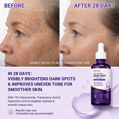 🗽❤️❤️❤️❤️Rolimey® Age Renewal Dark Spot Serum — Infused with 10% Niacinamide, Tranexamic Acid & Hyaluronic Acid for Brighter, Smoother-Looking Mature Skin