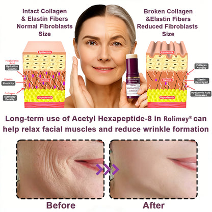 #1 Bestselling🏆--Rolimey® Calcium Multi Balm🗽🔖Anti-Aging & Firming Skincare Stick🔥- Last Day Promotion 50% OFF