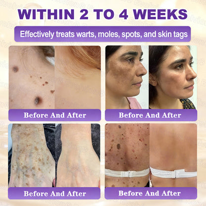 Made and Shipped from USA 🗽🔖Evolvion® Biotin 10-in-1 Skin Restoration Cream🍀- Last Day Promotion: 50% OFF