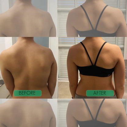 🧍‍♂️Avasoma® |🗽Professional Posture Corrector.Discreetly invisible under clothes for lasting spinal health. Start standing better!