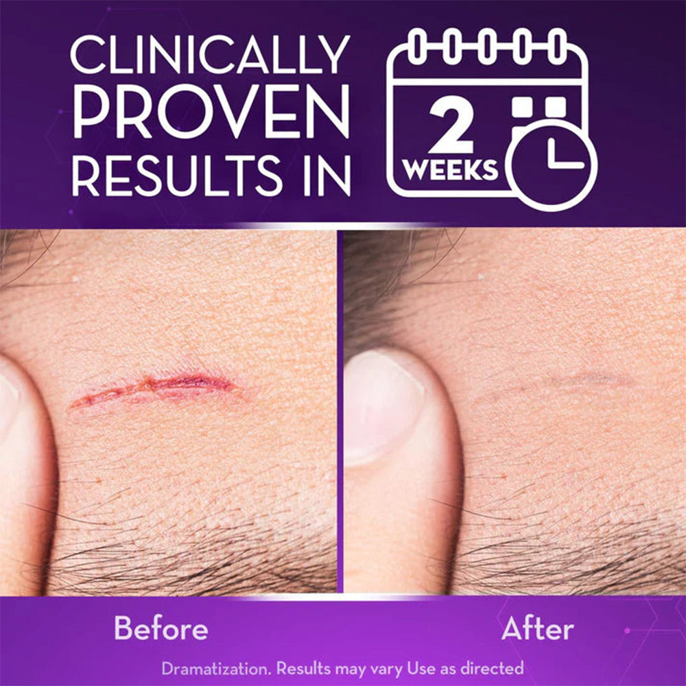 Celsiora® Stem Cell Scar Gel –🗽Treats old and new scars, helps reduce the appearance of scars from acne, surgery, burns, injuries, and stretch marks