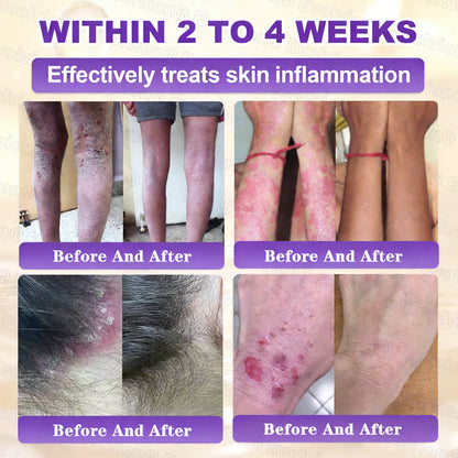 Made and Shipped from USA 🗽🔖Evolvion® Biotin 10-in-1 Skin Restoration Cream🍀- Last Day Promotion: 50% OFF