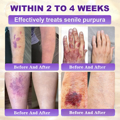 Made and Shipped from USA 🗽🔖Evolvion® Biotin 10-in-1 Skin Restoration Cream🍀- Last Day Promotion: 50% OFF