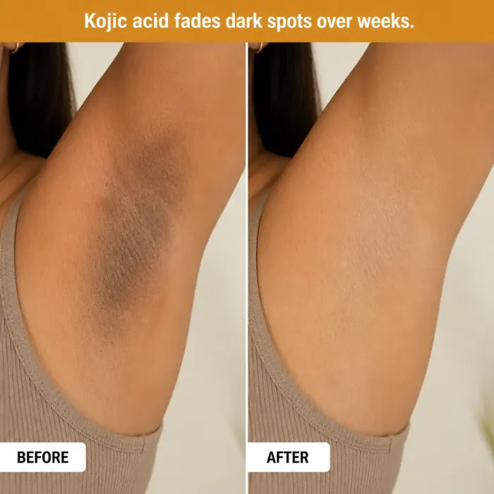 🗽Evolvion® Kojic Acid & Turmeric Exfoliating Spray — Body & Foot Care