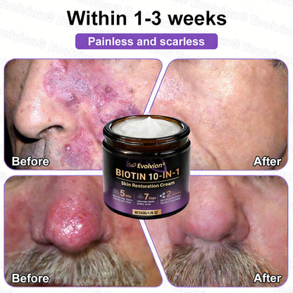 Made and Shipped from USA 🗽🔖Evolvion® Biotin 10-in-1 Skin Restoration Cream🍀- Last Day Promotion: 50% OFF