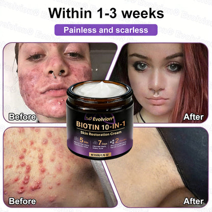 Made and Shipped from USA 🗽🔖Evolvion® Biotin 10-in-1 Skin Restoration Cream🍀- Last Day Promotion: 50% OFF