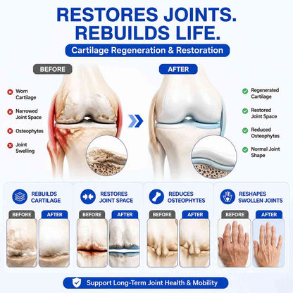 🗽❤️❤️❤️❤️GFOUK® Advanced Joint Support Cream