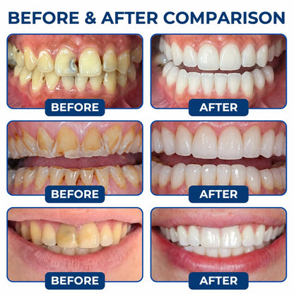 🗽🎁Dr.Fachmer® DentRestore Tooth Repair & Filling System