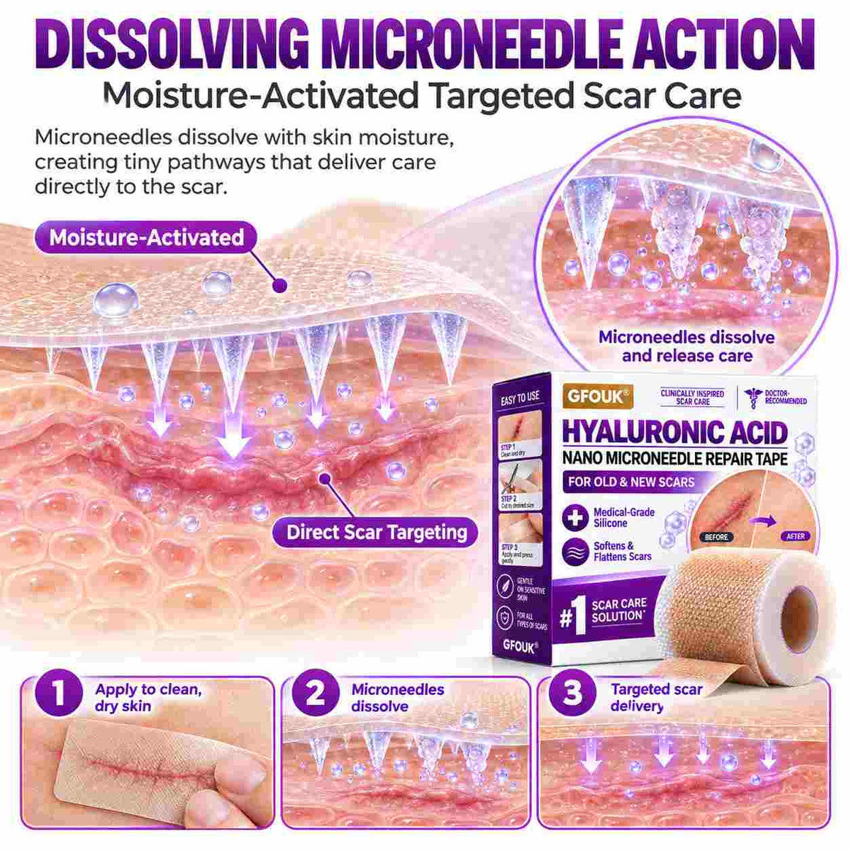 ✅GFOUK® Hyaluronic Acid Nano Microneedle Repair Tape for Surgical, C-Section, Raised & Stubborn Scars🗽⭐