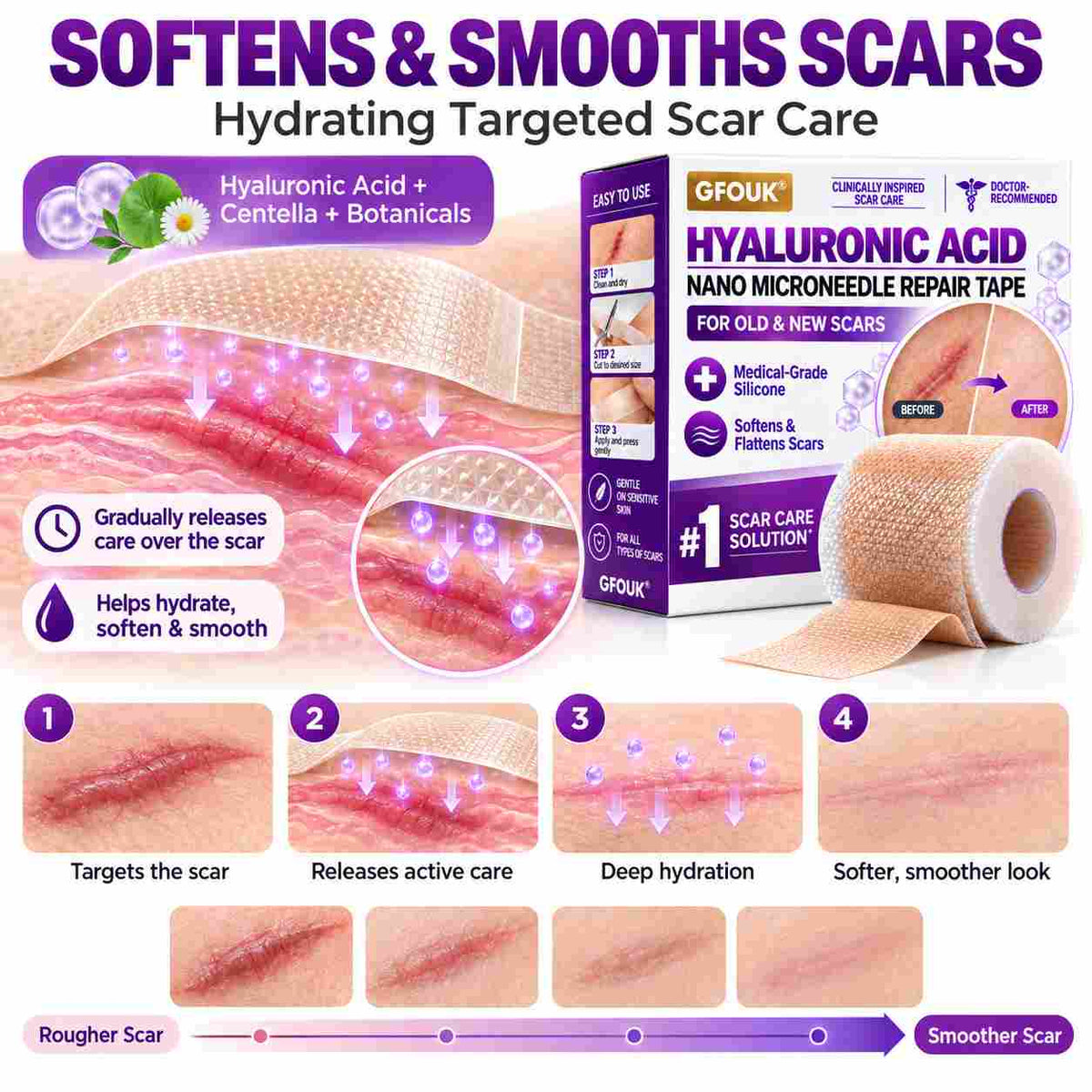 ✅GFOUK® Hyaluronic Acid Nano Microneedle Repair Tape for Surgical, C-Section, Raised & Stubborn Scars🗽⭐