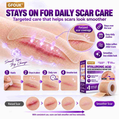 ✅GFOUK® Hyaluronic Acid Nano Microneedle Repair Tape for Surgical, C-Section, Raised & Stubborn Scars🗽⭐